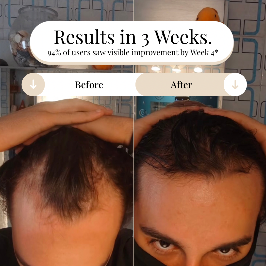 The AurixBrush™ – The Shortcut to Thicker, Fuller Hair